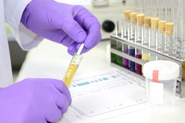 FMCSA Increases Random Drug Testing Rate to 50%