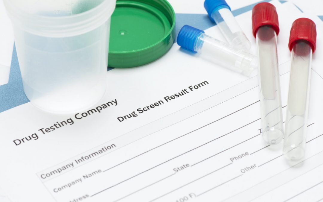 Synthetic Urine Getting Flushed by States