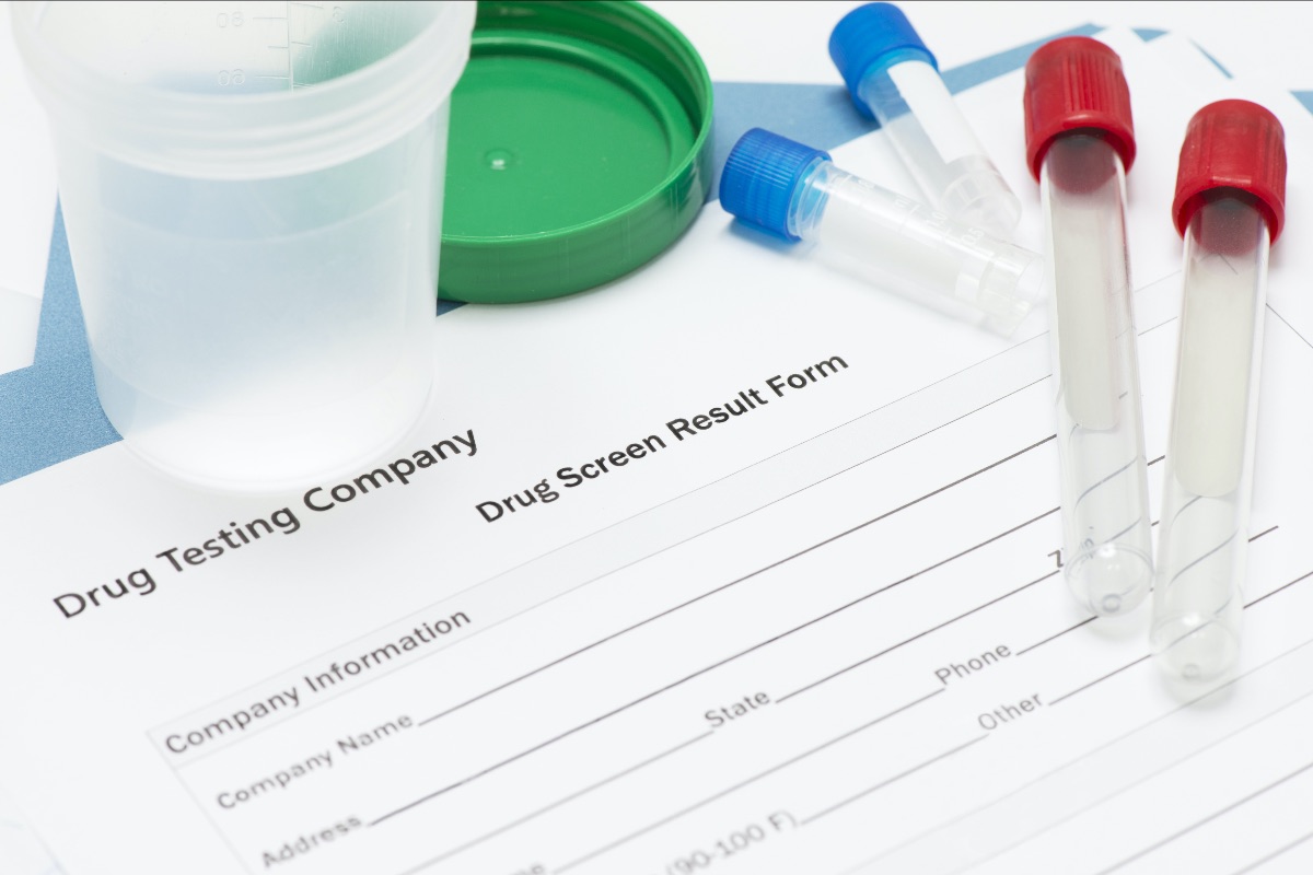 synthetic urine